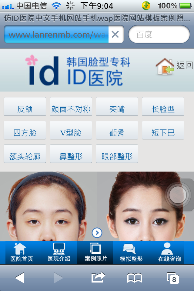 仿ID医院中文手机网站手机wap医院网站模板整形案例