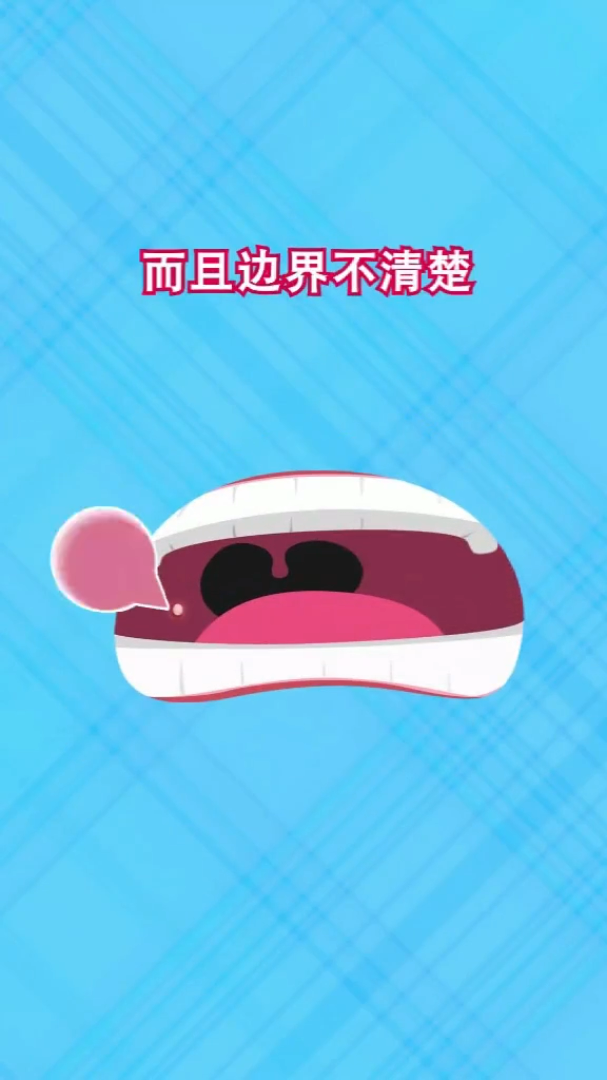 口腔溃疡变化健康养身生活科普竖屏无水印短视频素材免费下载